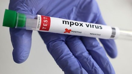 WHO Declares M-Pox a Public Health Emergency Again as Global Cases Surge | mPox Virus